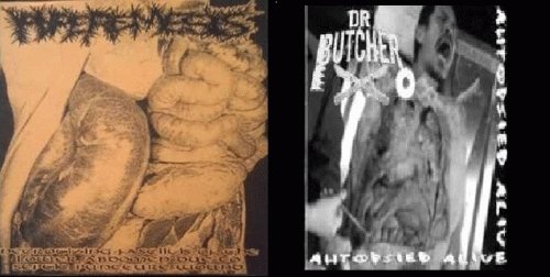 Hyperemesis : Hyperemesis - Dr. Butcher